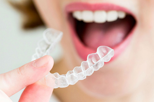 Invisalign Invisible Braces - Orillia Dentist Orthodontics