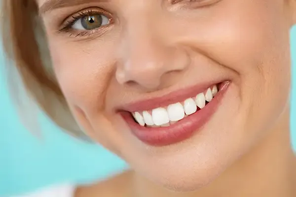 A close-up of a woman’s perfect smile with bright white teeth, illustrating the benefits of professional cosmetic dentistry.