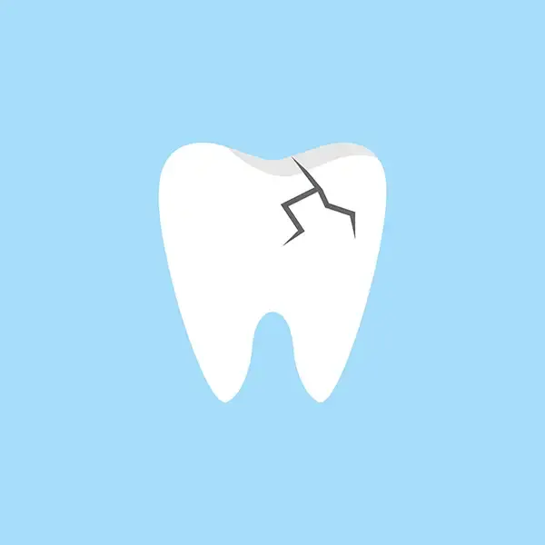 A cartoon tooth with an angular crack breaking off in two segments, representing a broken filling.