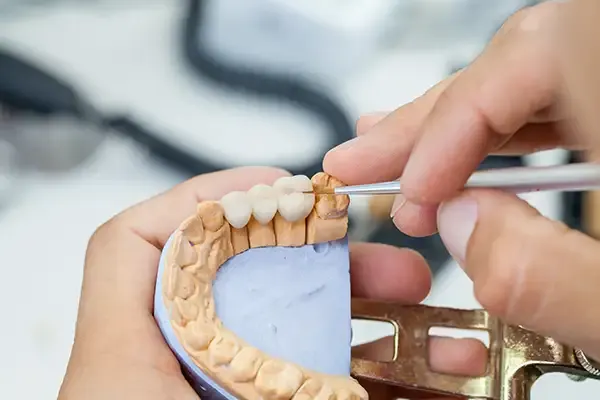 A dental technician completing precise finishing touches on a dental bridge.