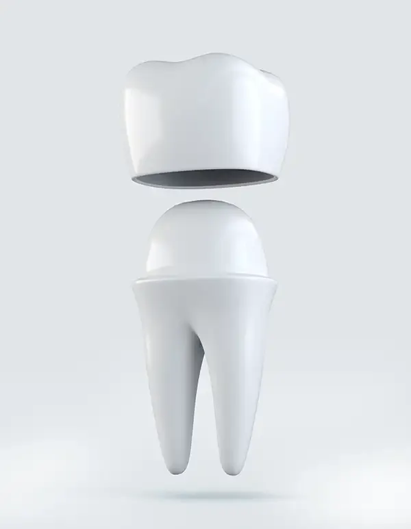 A model of a single tooth which has been rounded to allow a dental crown to be place on it.
