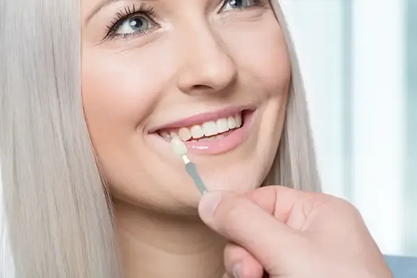 Dentist holding a dental veneer shade guide next to a smiling patient’s teeth to match the perfect color for veneers.