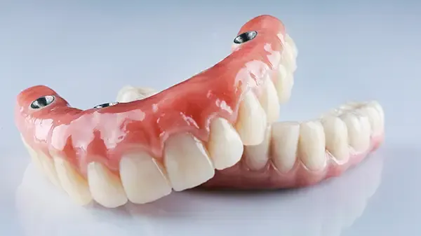 Close-up view of upper and lower full-arch implant-supported dentures designed for secure tooth replacement.