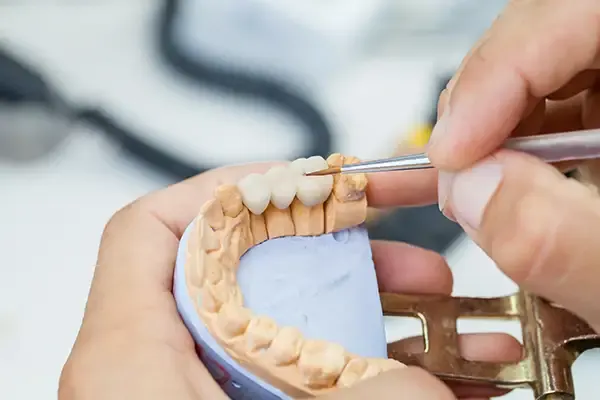 Dental technician working on a custom dental crown in a laboratory using precision tools.