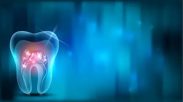 Abstract illustration of a tooth showing nerve inflammation, representing root canal treatment.