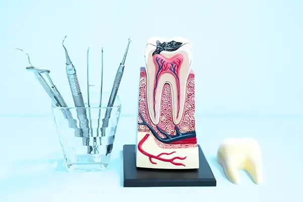 Tooth model displaying internal structure with dental tools used for root canal procedures.