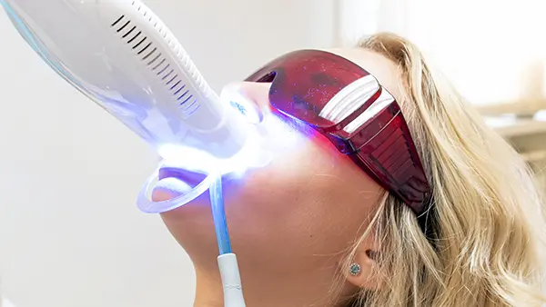 A special UV light lamp lightens a patient's teeth during a teeth whitening procedure.